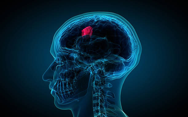 Possible Ways How You Can Get Treated for a Brain Tumor